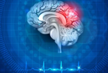 World Stroke Day