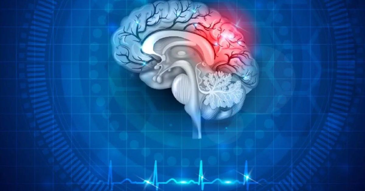 World Stroke Day